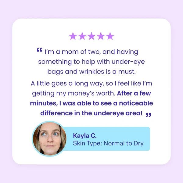 š„Instant Lift Eye Gelš„ ā Reduce the Look of Eye Bags in Minutes