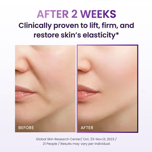 🔥Limited Time Offer🔥 3D Lifting Night Cream — Wake Up to Firmer, Smoother-Looking Skin